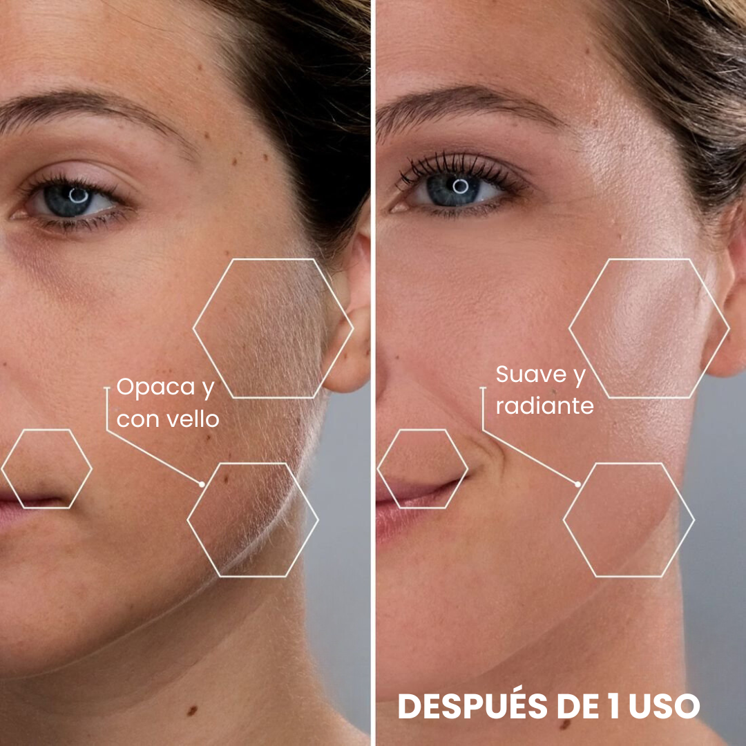 Dermaplaning Pro - Velux